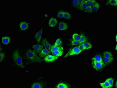 HACD2 / PTPLB Antibody