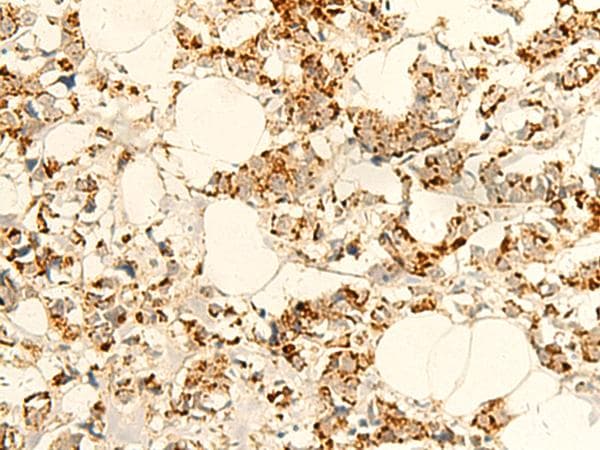 NAPRT Antibody