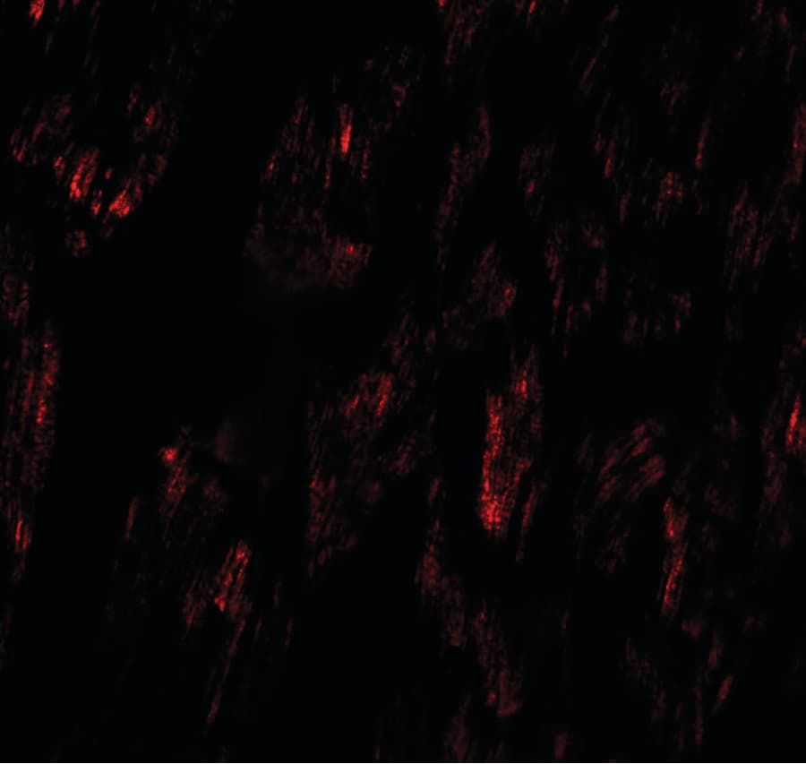 FCHO2 Antibody