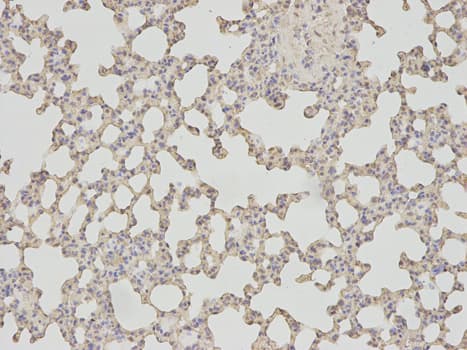 IHC-plus™ Polyclonal Rabbit anti-Human PSMA1 Antibody (IHC, IF, WB)