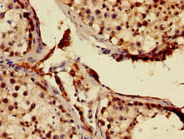 Polyclonal Rabbit anti-Human MNAT1 Antibody (IHC, WB)