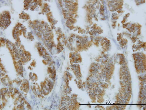 NODAL Antibody (clone 5C3)
