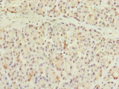 CCDC116 Antibody (Coiled-coil domain)