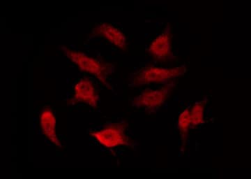 Polyclonal Rabbit anti-Human GPR156 Antibody (IF, WB)