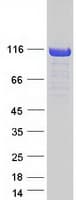 Human CYLD Protein (Recombinant Myc-DDK (Flag))