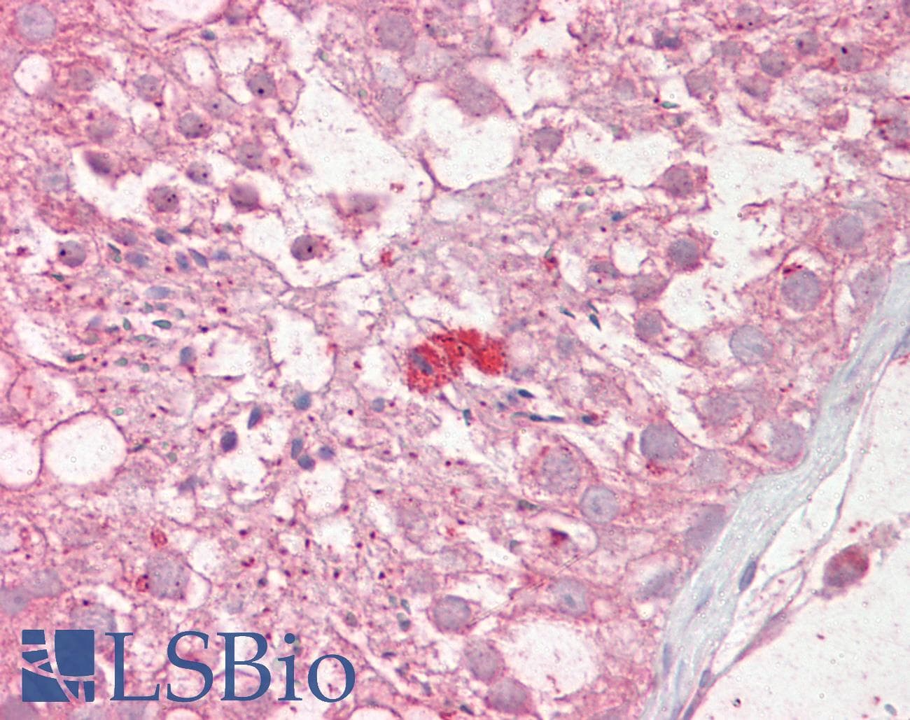 IHC-plus™ TRIM69 / Trif Antibody (aa329-341)