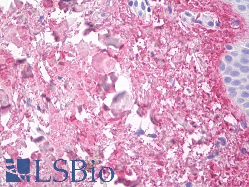 IHC-plus™ Monoclonal Mouse anti-Human COL5A1 / Collagen V Alpha 1 Antibody (clone 13F6, IHC, WB)