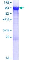 Human AICAR / ATIC Protein (Recombinant GST)