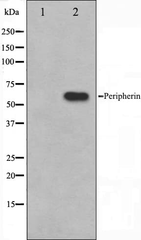 Peripherin Antibody (aa445-470)