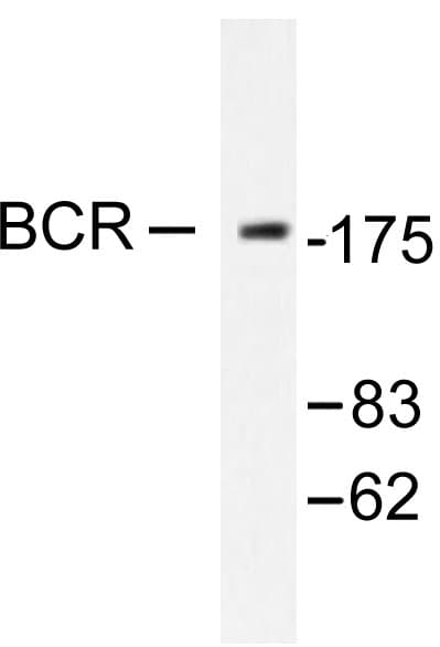 Polyclonal Rabbit anti-Human CML / BCR Antibody (Asp171, IHC, WB)