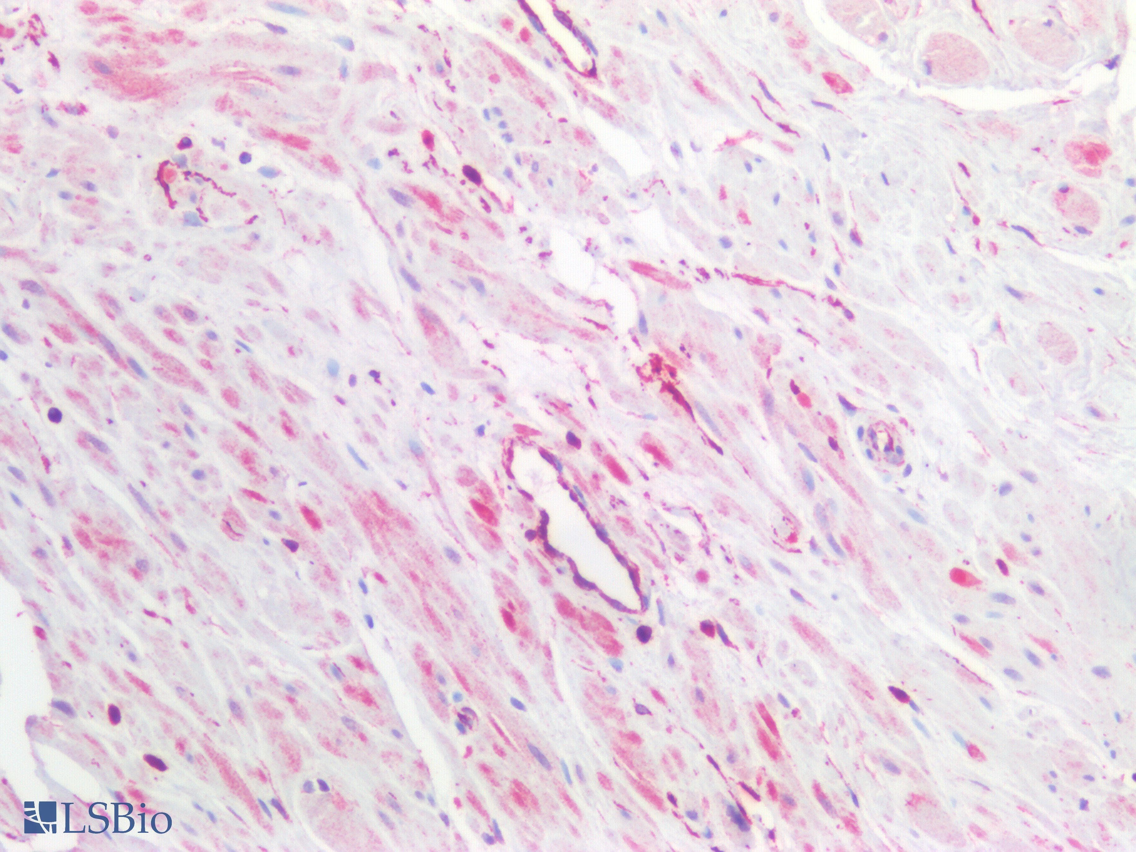 IHC-plus™ GPC3 / Glypican 3 Antibody (clone 2C12)