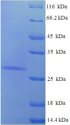 Human AQP1 / Aquaporin 1 Protein (Recombinant His-SUMO)