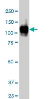 IHC-plus™ Monoclonal Mouse anti-Human ATP2A1 / SERCA1 Antibody (clone 1B11, IHC, IF, WB)