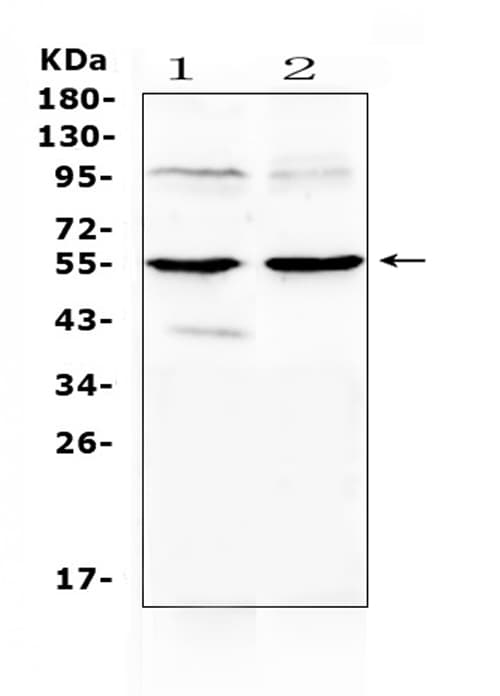 MMP10 Antibody