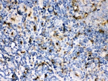Polyclonal Rabbit anti-Human CSTA / Cystatin A Antibody (IHC, WB)