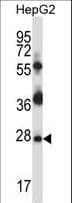 PRPK / TP53RK Antibody (aa100-128)