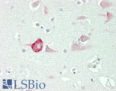 IHC-plus™ Polyclonal Rabbit anti-Human EF1G / EEF1G Antibody (aa200-250, IHC, WB)