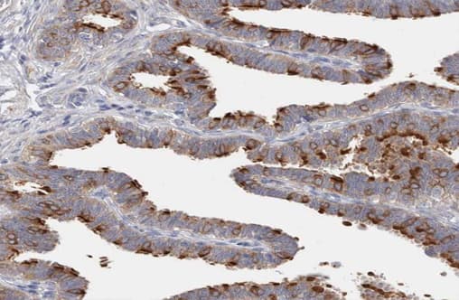 DLEC1 / DLC1 Antibody