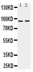 ADAMTS4 Antibody (aa820-837)