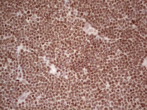 Monoclonal Mouse anti-Human NR3C1/Glucocorticoid Receptor Antibody (clone OTI6B5, aa1-265, IHC, WB)