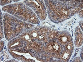 UBE2G2 Antibody (clone OTI1D7)