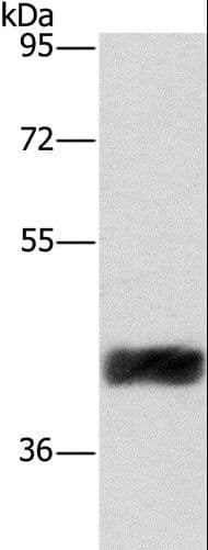 Polyclonal Rabbit anti-Human CRELD2 Antibody (IHC, WB)