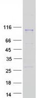 Human FOLH1 / PSMA Protein (Recombinant Myc-DDK (Flag), C-terminus)