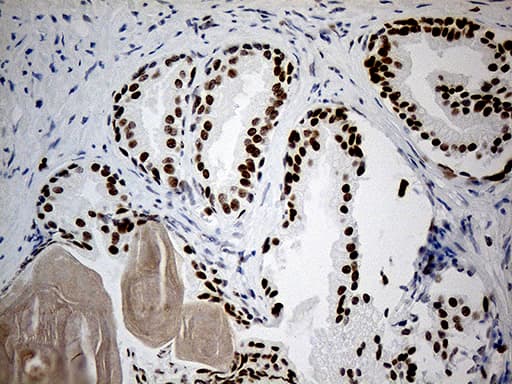 Monoclonal Mouse anti-Human RB1 / Retinoblastoma / RB Antibody (clone OTI11C10, aa309-590, IHC, WB)