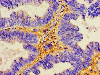 DSG2 / Desmoglein 2 Antibody