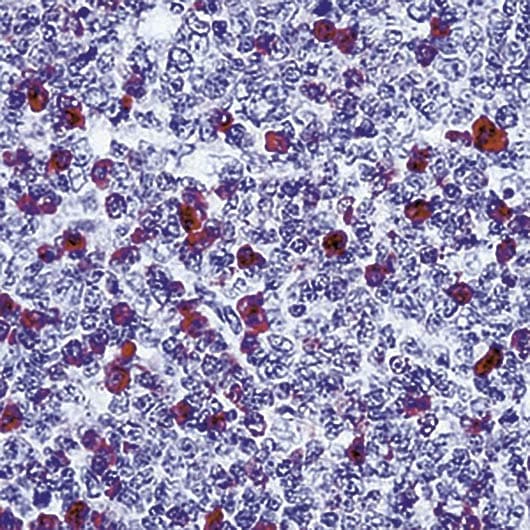Rabbit Anti-Human IgG Secondary Antibody