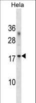 RPL36A / Ribosomal Protein L36 Antibody (aa74-102)