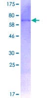 Human SIRT7 / Sirtuin 7 Protein (Recombinant GST)