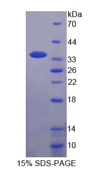 Bovine TFF3 / Trefoil Factor 3 Protein (Recombinant His-GST-S)