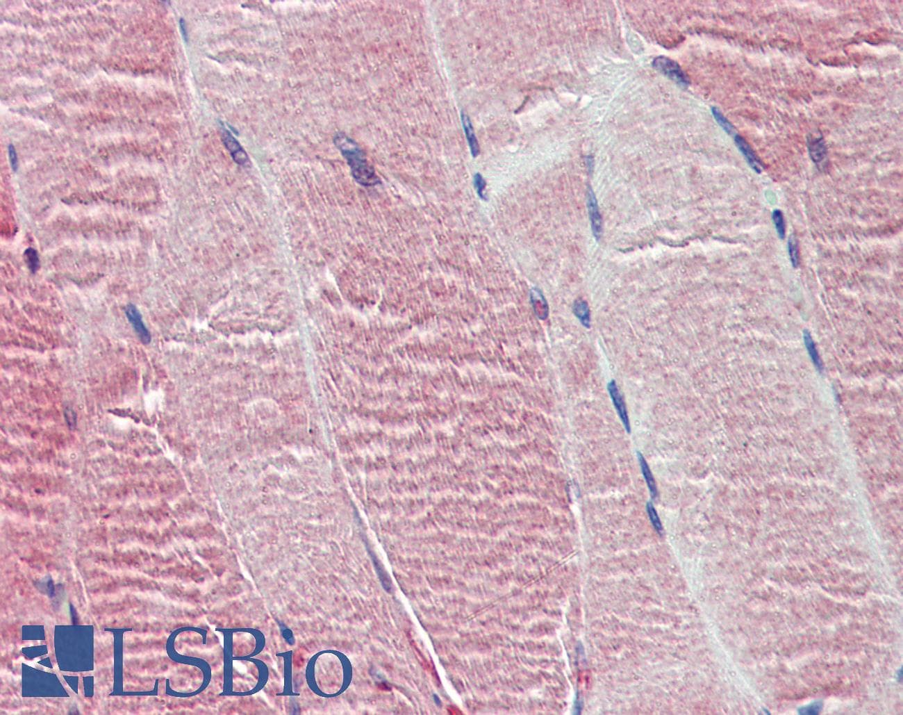 IHC-plus™ Polyclonal Rabbit anti-Human HTR2C / 5-HT2C Receptor Antibody (IHC, WB)