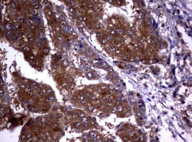 VILIP / VSNL1 Antibody (aa2-191, clone OTI1F7)