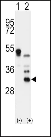 IHC-plus™ APOD / Apolipoprotein D Antibody (aa26-53)