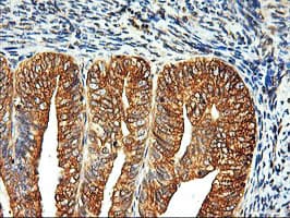 ERGIC-53 / LMAN1 Antibody (clone OTI1C5)
