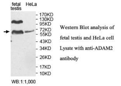 ADAM2 / Fertilin Beta Antibody (aa411-653)