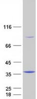 Human TOMM34 Protein (Recombinant Myc-DDK (Flag))