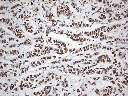 EWSR1 / EWS Antibody (aa256-447, clone OTI3F6, Carrier-free)