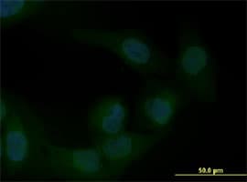 Monoclonal Mouse anti-Human ZEB1 / AREB6 Antibody (clone 4C4, IF, WB)