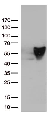 Monoclonal Mouse anti-Human Vimentin Antibody (clone UMAB160, IHC, IF, WB)