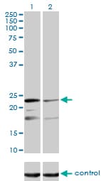 Monoclonal Mouse anti-Human MRPL12 Antibody (clone 3B12-1A3, IHC, IF, WB)