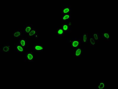 Polyclonal Rabbit anti-Human HIST1H4I Antibody (IHC, IF)