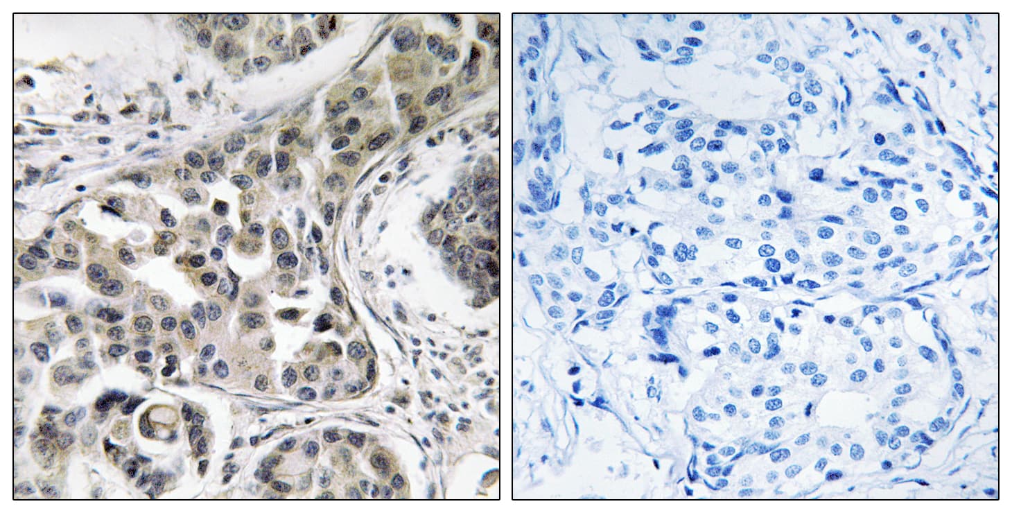USP6NL Antibody (aa451-500)