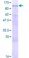 Human ZNF41 Protein (Recombinant GST)