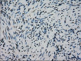 HSPA9 / Mortalin / GRP75 Antibody (clone OTI9F8)