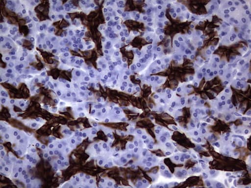 Monoclonal Mouse anti-Human KRT19 / CK19 / Cytokeratin 19 Antibody (clone OTI6E8, aa240-390, IHC)