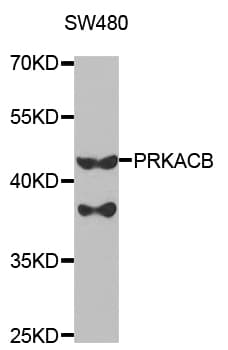 Polyclonal Rabbit anti-Human PRKACB Antibody (IHC, IF, WB)