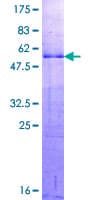 Human DLX1 Protein (Recombinant GST)